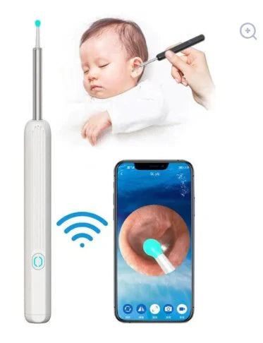 Earwax Removal Kit with Camera Clean Ears with Precision & Confidence