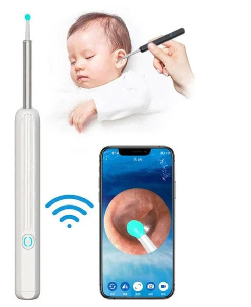Earwax Removal Kit with Camera Clean Ears with Precision & Confidence