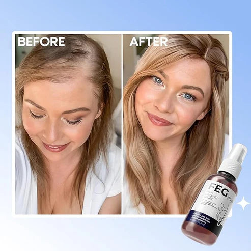 FEG Plus Hair Growth Spray Boost Regrowth Stop Hair Fall & Restore Confidence